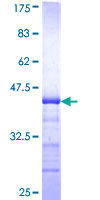 TEM7 Protein - 12.5% SDS-PAGE Stained with Coomassie Blue