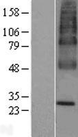 TERE1 / UBIAD1 Protein - Western validation with an anti-DDK antibody * L: Control HEK293 lysate R: Over-expression lysate