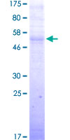 TERE1 / UBIAD1 Protein - 12.5% SDS-PAGE of human UBIAD1 stained with Coomassie Blue