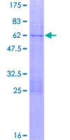 TERF2 / TRF2 Protein - 12.5% SDS-PAGE of human TERF2 stained with Coomassie Blue