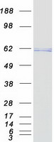 TERF2 / TRF2 Protein - Purified recombinant protein TERF2 was analyzed by SDS-PAGE gel and Coomassie Blue Staining