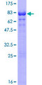 TERF2IP / RAP1 Protein - 12.5% SDS-PAGE of human TERF2IP stained with Coomassie Blue