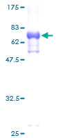 TES / Testin Protein - 12.5% SDS-PAGE of human TES stained with Coomassie Blue