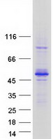 TES / Testin Protein - Purified recombinant protein TES was analyzed by SDS-PAGE gel and Coomassie Blue Staining