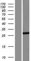 TESC Protein - Western validation with an anti-DDK antibody * L: Control HEK293 lysate R: Over-expression lysate