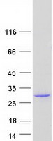 TESC Protein - Purified recombinant protein TESC was analyzed by SDS-PAGE gel and Coomassie Blue Staining
