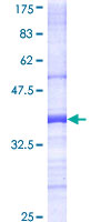 TESK1 Protein - 12.5% SDS-PAGE Stained with Coomassie Blue.