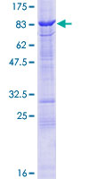 TESK2 Protein - 12.5% SDS-PAGE of human TESK2 stained with Coomassie Blue