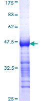 TESK2 Protein - 12.5% SDS-PAGE Stained with Coomassie Blue.