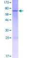 TESPA1 / KIAA0748 Protein - 12.5% SDS-PAGE of human TESPA1 stained with Coomassie Blue
