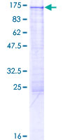 TEX10 Protein - 12.5% SDS-PAGE of human TEX10 stained with Coomassie Blue