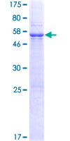 TEX101 Protein - 12.5% SDS-PAGE of human TEX101 stained with Coomassie Blue