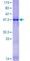 TEX19 Protein - 12.5% SDS-PAGE of human FLJ35767 stained with Coomassie Blue