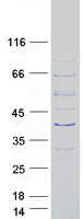 TEX26 / C13orf26 Protein - Purified recombinant protein TEX26 was analyzed by SDS-PAGE gel and Coomassie Blue Staining