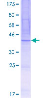 TEX261 Protein - 12.5% SDS-PAGE of human TEX261 stained with Coomassie Blue