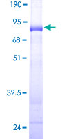 TEX28 Protein - 12.5% SDS-PAGE of human CXorf2 stained with Coomassie Blue