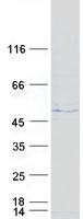 TEX28 Protein - Purified recombinant protein TEX28 was analyzed by SDS-PAGE gel and Coomassie Blue Staining