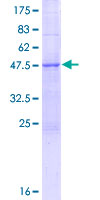 TEX30 / C13orf27 Protein - 12.5% SDS-PAGE of human C13orf27 stained with Coomassie Blue