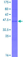 TEX43 / C5orf48 Protein - 12.5% SDS-PAGE of human FLJ27505 stained with Coomassie Blue