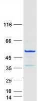 TEX9 Protein - Purified recombinant protein TEX9 was analyzed by SDS-PAGE gel and Coomassie Blue Staining