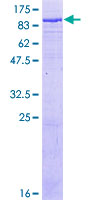 TF / Transferrin Protein - 12.5% SDS-PAGE of human TF stained with Coomassie Blue