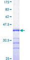 TF / Transferrin Protein - 12.5% SDS-PAGE Stained with Coomassie Blue.