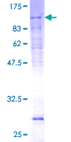 TFB1 / GTF2H1 Protein - 12.5% SDS-PAGE of human GTF2H1 stained with Coomassie Blue