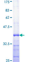 TFB1 / GTF2H1 Protein - 12.5% SDS-PAGE Stained with Coomassie Blue.
