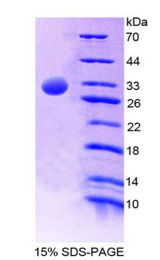 TFB1 / GTF2H1 Protein - Recombinant General Transcription Factor IIH, Polypeptide 1 By SDS-PAGE