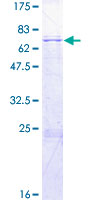 TFB2M Protein - 12.5% SDS-PAGE of human TFB2M stained with Coomassie Blue