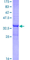 TFB2M Protein - 12.5% SDS-PAGE Stained with Coomassie Blue.