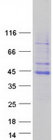 TFB2M Protein - Purified recombinant protein TFB2M was analyzed by SDS-PAGE gel and Coomassie Blue Staining