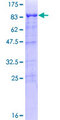 TFCP2 / CP2 Protein - 12.5% SDS-PAGE of human TFCP2 stained with Coomassie Blue