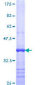 TFCP2 / CP2 Protein - 12.5% SDS-PAGE Stained with Coomassie Blue.