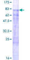 TFDP1 Protein - 12.5% SDS-PAGE of human TFDP1 stained with Coomassie Blue