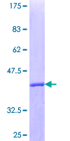 TFDP1 Protein - 12.5% SDS-PAGE Stained with Coomassie Blue.