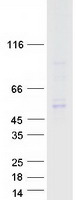 TFDP1 Protein - Purified recombinant protein TFDP1 was analyzed by SDS-PAGE gel and Coomassie Blue Staining