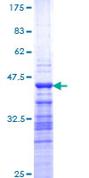 TFDP2 / DP2 Protein - 12.5% SDS-PAGE Stained with Coomassie Blue.