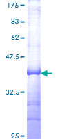 TFDP3 Protein - 12.5% SDS-PAGE Stained with Coomassie Blue.