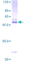 TFEC Protein - 12.5% SDS-PAGE of human TFEC stained with Coomassie Blue