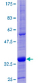TFF1 / pS2 Protein - 12.5% SDS-PAGE of human TFF1 stained with Coomassie Blue