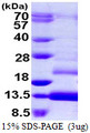 TFF1 / pS2 Protein