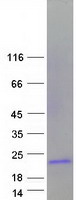 TFF1 / pS2 Protein - Purified recombinant protein TFF1 was analyzed by SDS-PAGE gel and Coomassie Blue Staining