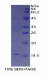 TFF2 / SP Protein - Recombinant Trefoil Factor 2 By SDS-PAGE