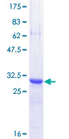 TFF3 / Trefoil Factor 3 Protein - 12.5% SDS-PAGE of human TFF3 stained with Coomassie Blue