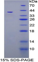 TFF3 / Trefoil Factor 3 Protein - Recombinant Trefoil Factor 3, Intestinal By SDS-PAGE