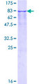 TFG Protein - 12.5% SDS-PAGE of human TFG stained with Coomassie Blue