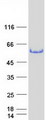 TFG Protein - Purified recombinant protein TFG was analyzed by SDS-PAGE gel and Coomassie Blue Staining
