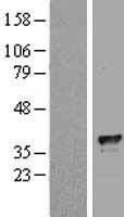TFIIB Protein - Western validation with an anti-DDK antibody * L: Control HEK293 lysate R: Over-expression lysate
