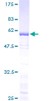 TFIIB Protein - 12.5% SDS-PAGE of human GTF2B stained with Coomassie Blue